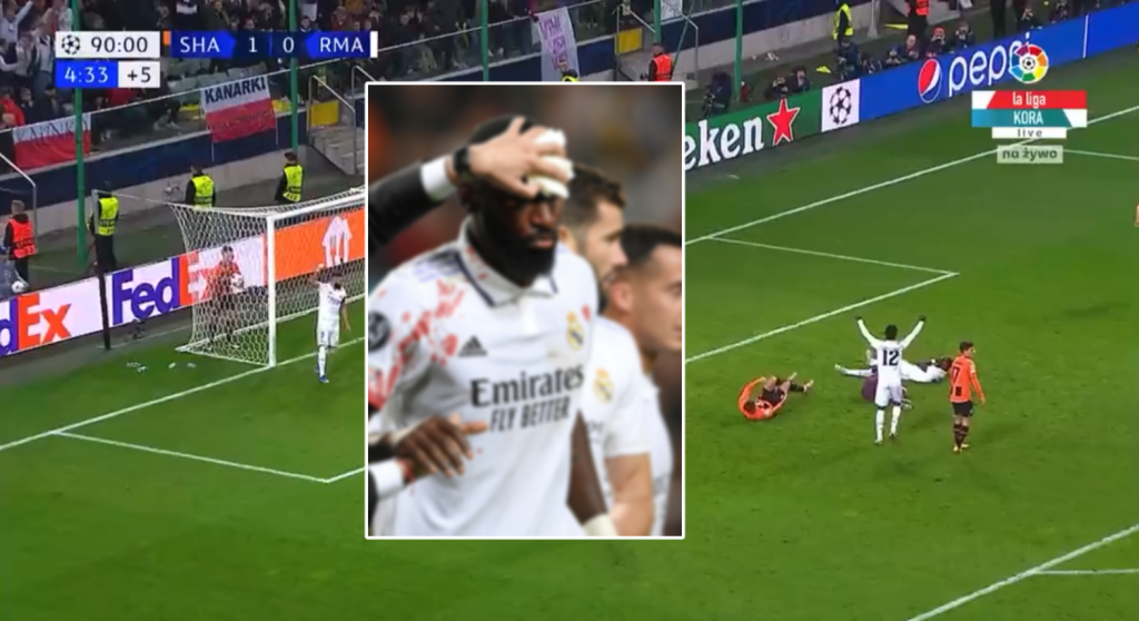 Momenti kur Rudiger shënoi në minutat shtesë dhe pësoi lëndim të rëndë! (Video)